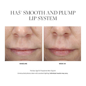 SkinMedica HA5 texture closeup displaying creamy finish for immediate smoothing effect