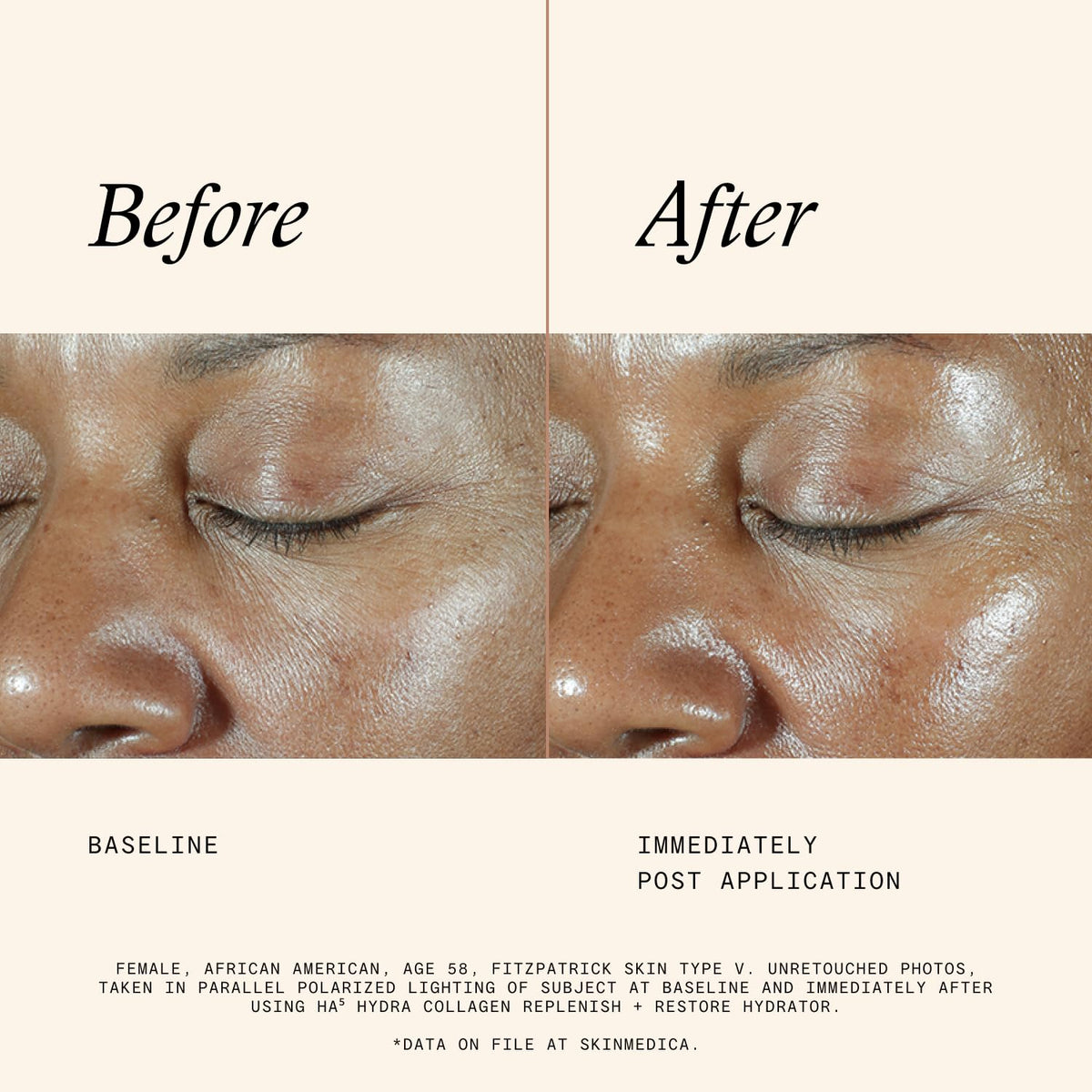 SkinMedica HA5 vegan collagen ingredient visual showing plant-based collagen benefit for plumper skin