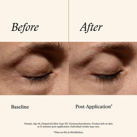 SkinMedica label detail with ingredient highlights, transparency about actives