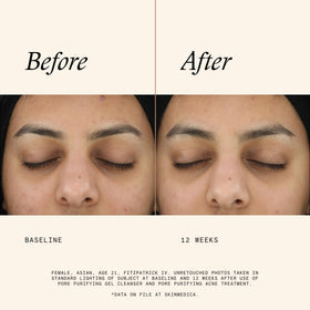 SkinMedica label close-up listing key ingredients and proven exfoliant benefits