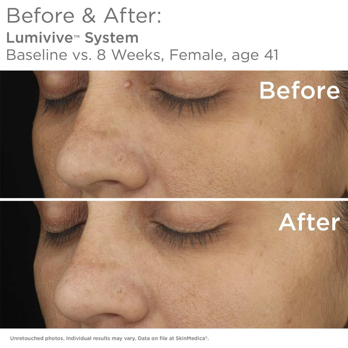 SkinMedica Day serum being applied to hand, illustrates layering under moisturizer and SPF