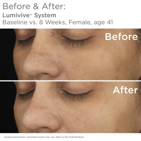 SkinMedica Day serum being applied to hand, illustrates layering under moisturizer and SPF