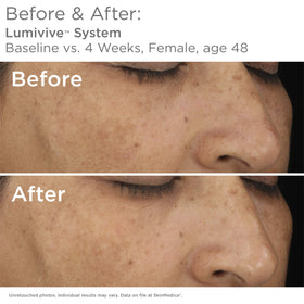 SkinMedica swatch of Lumivive Night complex texture on fingertip, demonstrates rich restorative finish