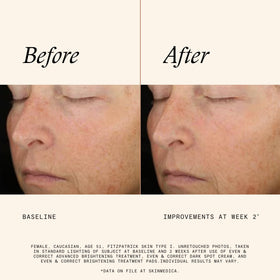SkinMedica pad being applied by hand to show ease and safe application