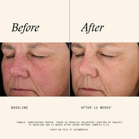 SkinMedica retinol 0.25 label detail and pump emphasizing ingredient clarity