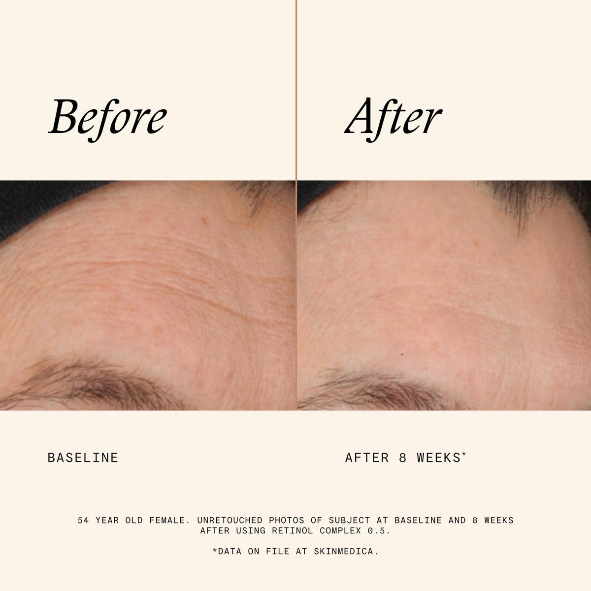 SkinMedica label showing ingredients list for transparency and informed choices