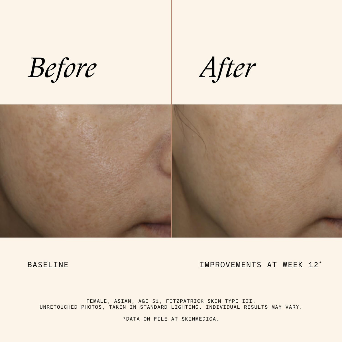 SkinMedica serum applied to hand demonstrating easy, lightweight application