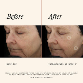 SkinMedica creamy serum texture close-up illustrating smooth absorption and hydrates skin