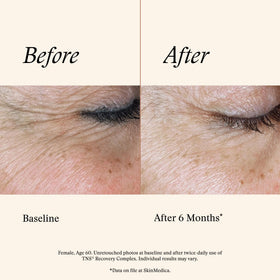 SkinMedica product on hand during application demonstrating lightweight feel and spreadability