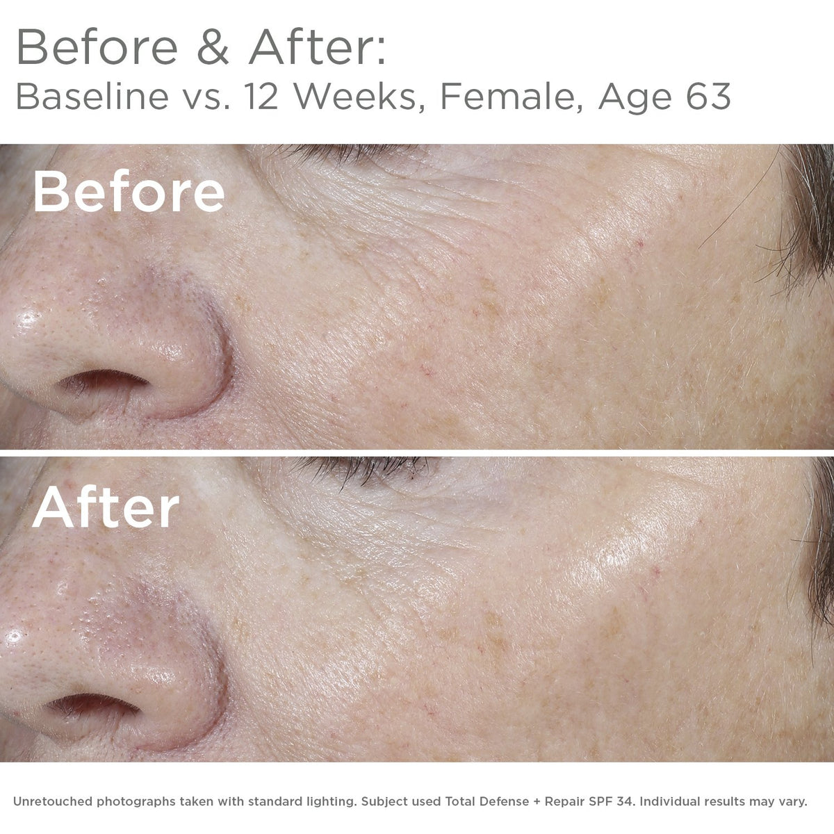 SkinMedica texture close-up emphasizing lightweight, non-greasy finish and blendability