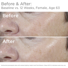 SkinMedica texture close-up emphasizing lightweight, non-greasy finish and blendability