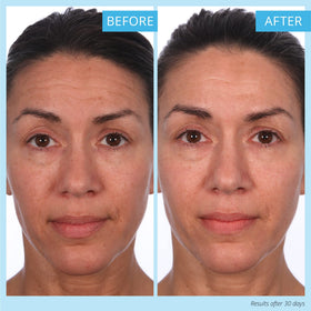 SKINN ingredient label showing ferulic acid retinol vitamin C transparency