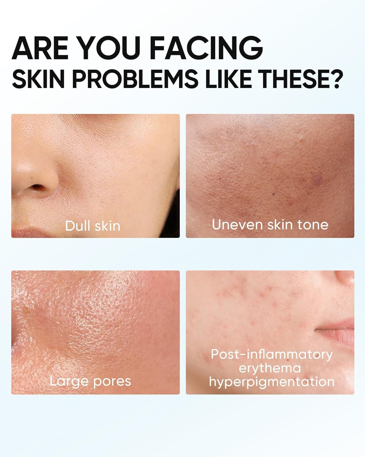 SKINTIFIC size comparison illustrating travel-friendly 250ml bottle benefit