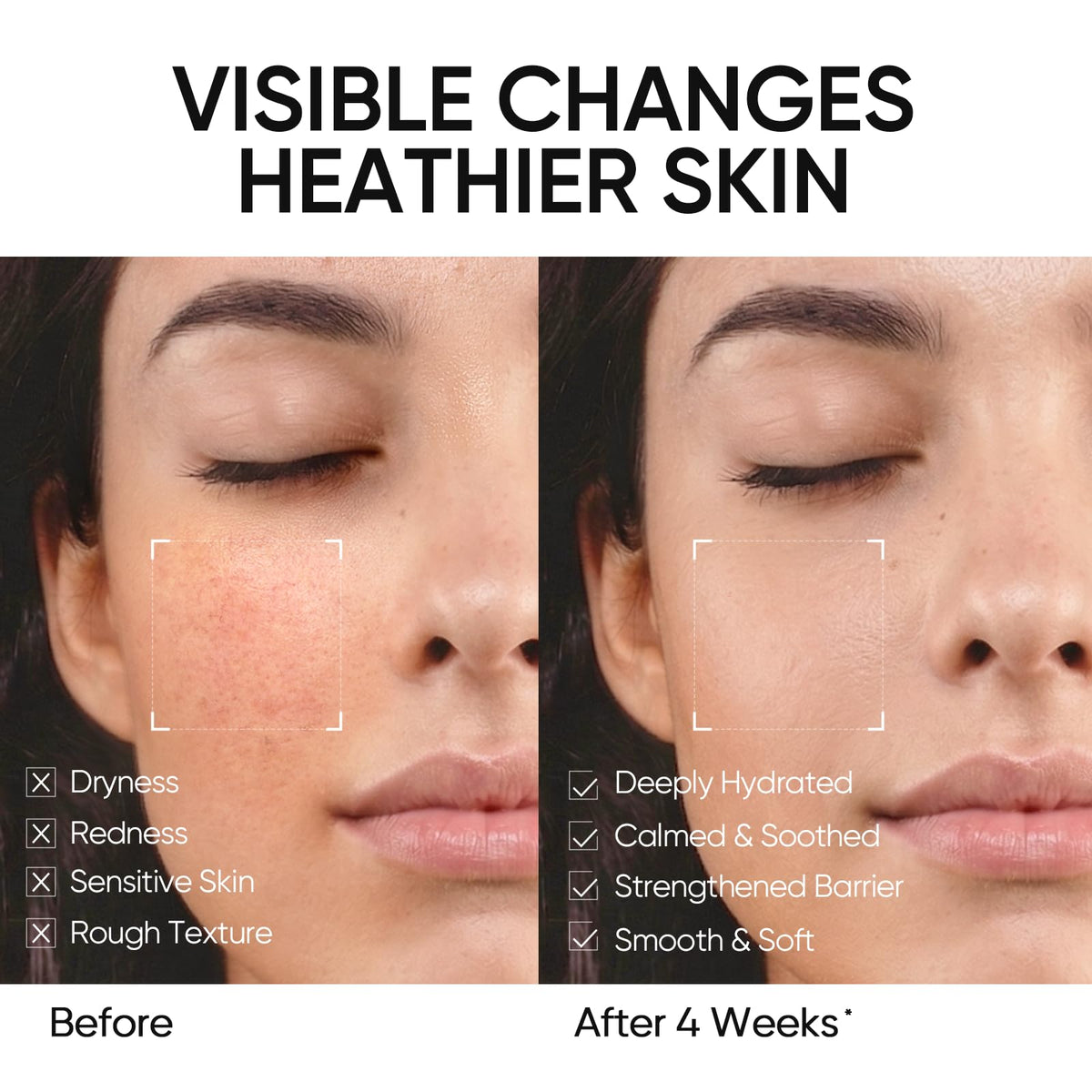 SKINTIFIC cream spread on skin demonstrating quick absorption benefit