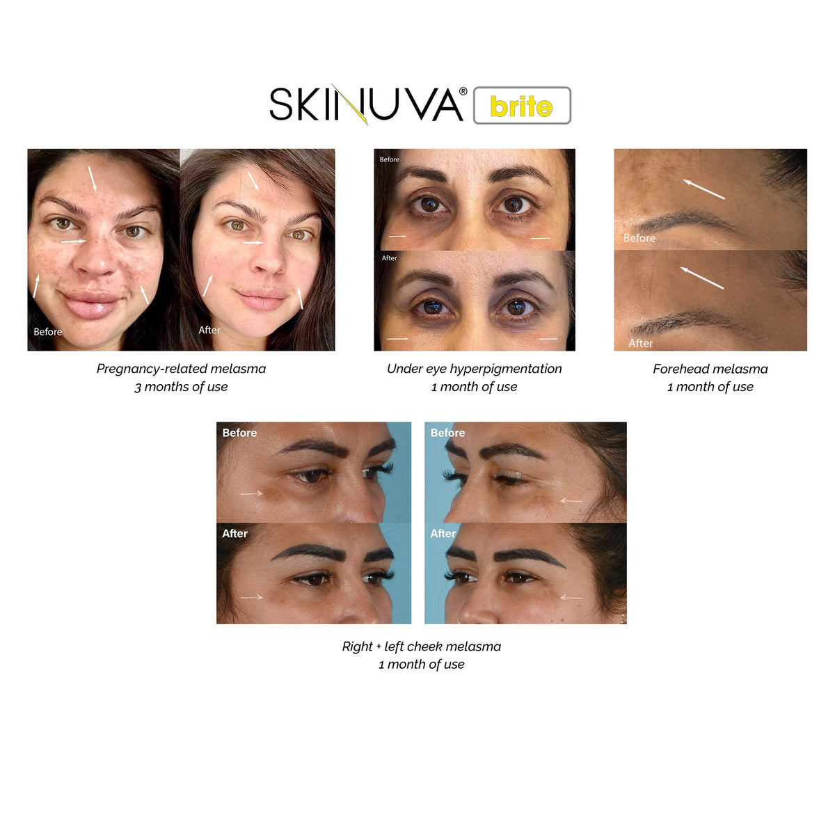 Skinuva Brite on bathroom counter in lifestyle shot showing everyday routine benefit