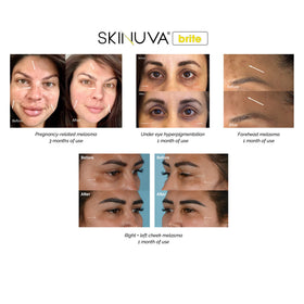Skinuva Brite on bathroom counter in lifestyle shot showing everyday routine benefit