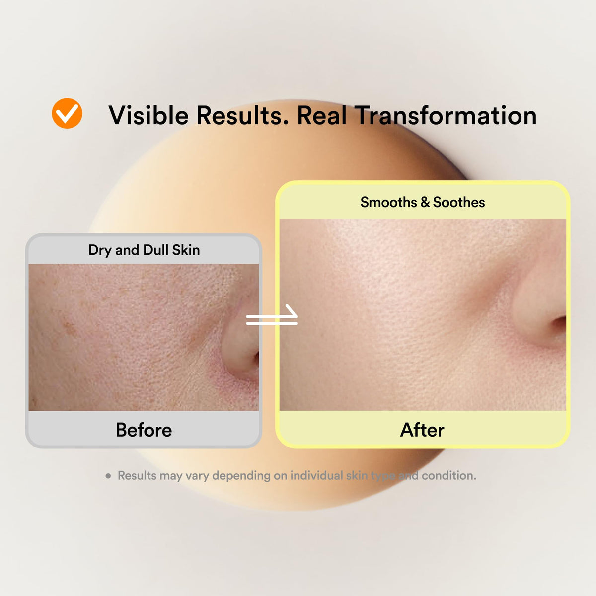 Skit serum being absorbed on skin to show non-greasy, silky feel benefit