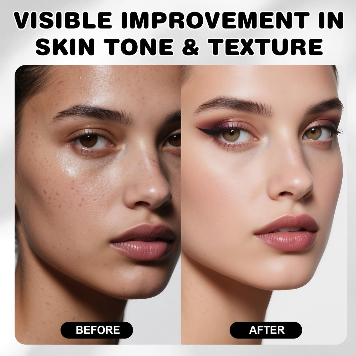 SKSOYT applied with derma roller demonstrating improved ingredient delivery