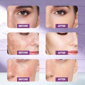 skynflow hand applying peel-off mask demonstrating easy at-home use