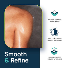 SLMD fine mist texture on skin demonstrating exfoliation and pore penetration