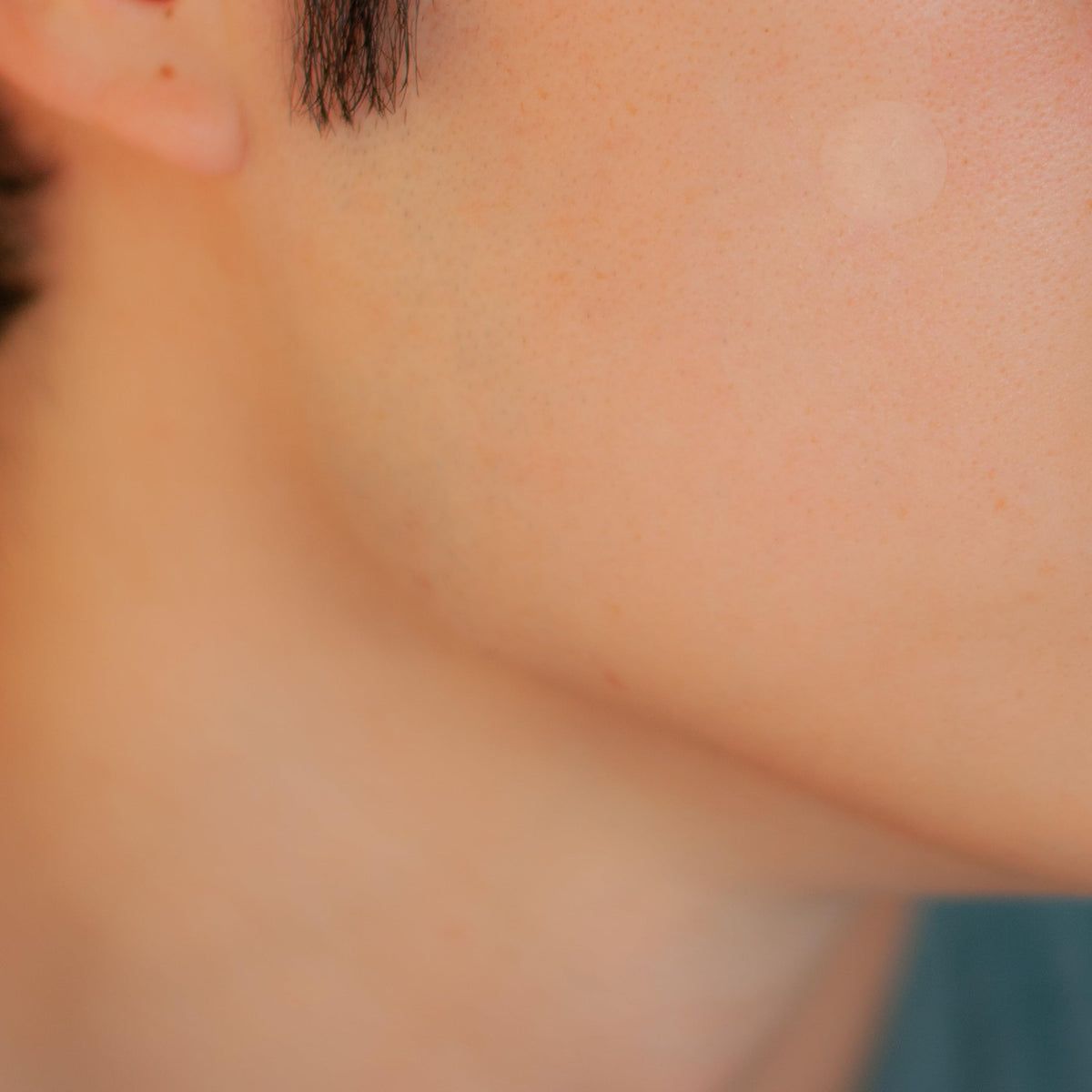 SMARTMED dot applied to cheek demonstrating discreet protection