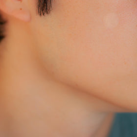 SMARTMED dot applied to cheek demonstrating discreet protection