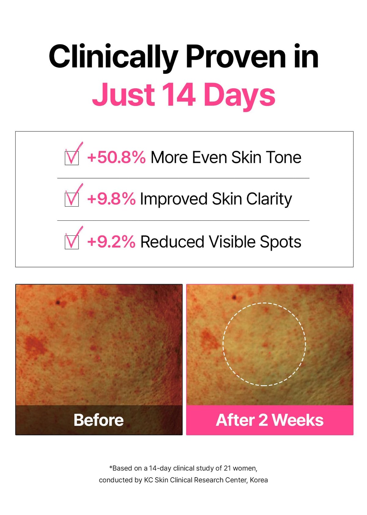 SNP bamboo side pad texture close-up offering gentle keratin removal for smoother skin