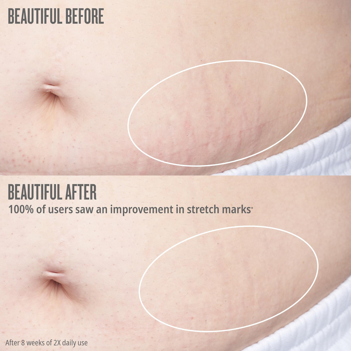 Sol de Janeiro applying oil to thigh lifestyle photo for firming benefit