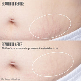 Sol de Janeiro applying oil to thigh lifestyle photo for firming benefit