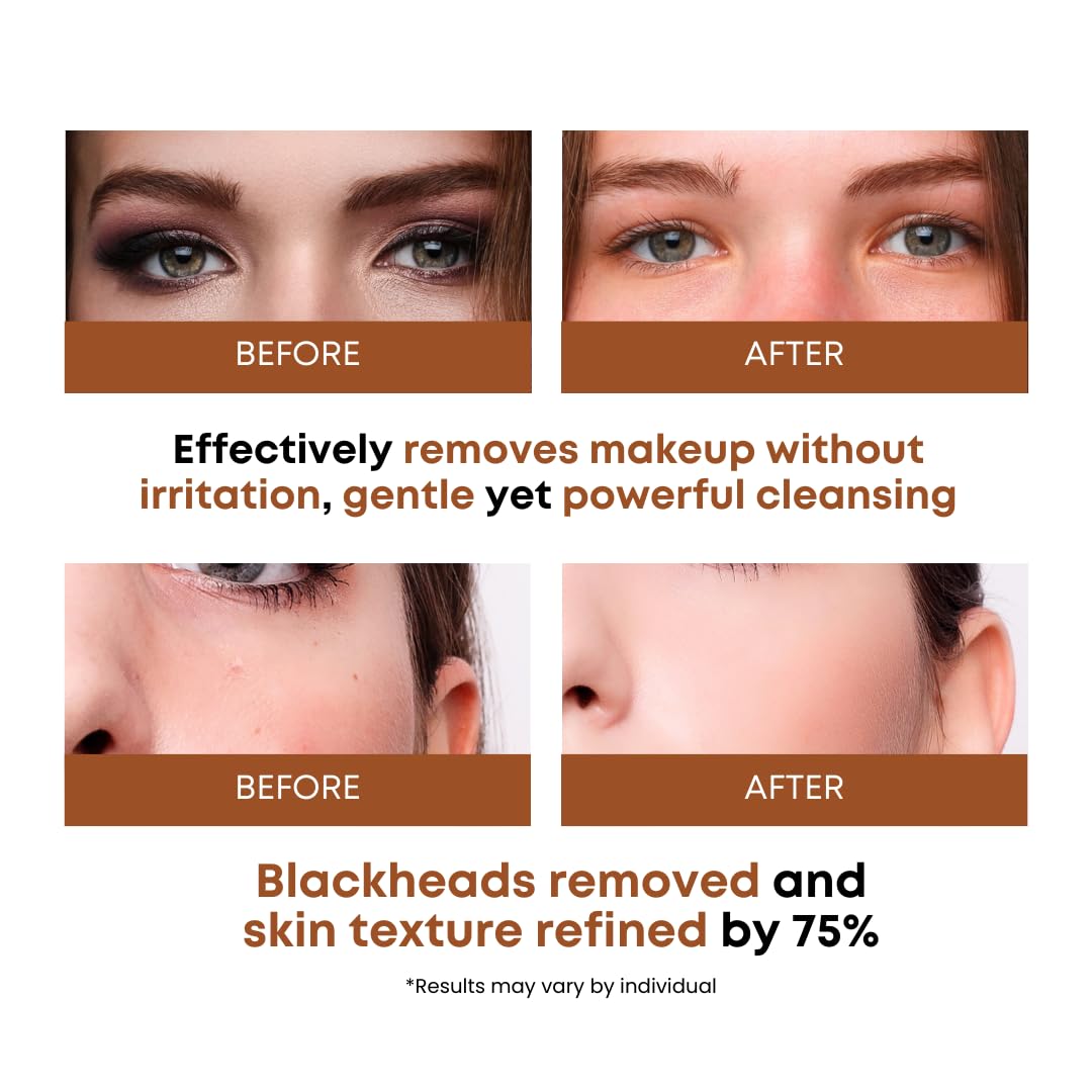 SOMISOME pad removing makeup to show quick effective cleansing