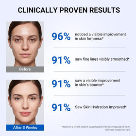SORNBEO bottle beside hyaluronic visual conveying deep hydration benefit