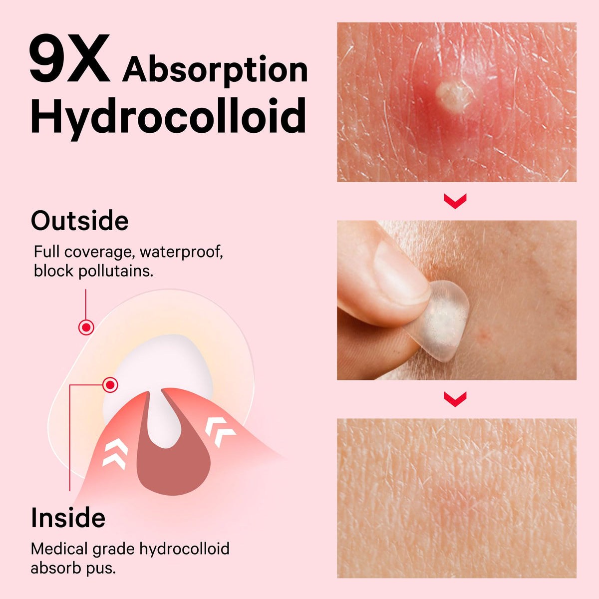 Sosky patch applied on cheek staying secure during daily activity benefit