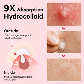 Sosky patch applied on cheek staying secure during daily activity benefit