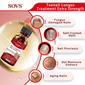 SOVS application close-up of drops on toenail demonstrating easy absorption benefit