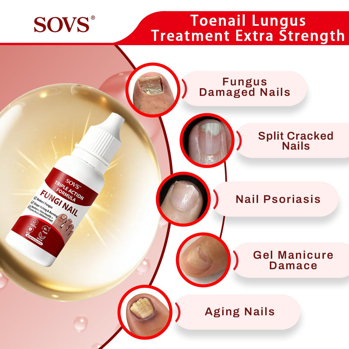 SOVS close-up of nail surface texture showing smoother appearance