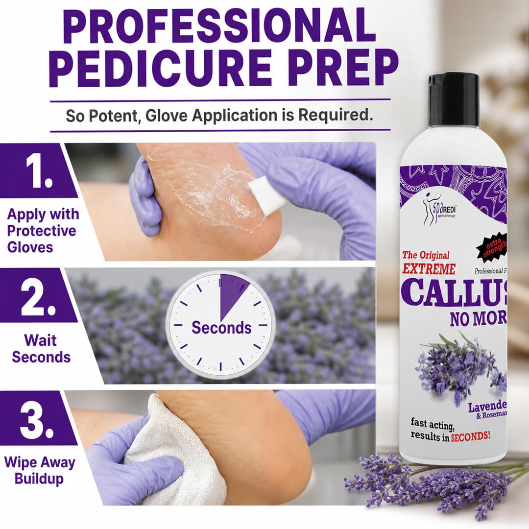 SPA REDI applied to heel in salon showing faster callus softening
