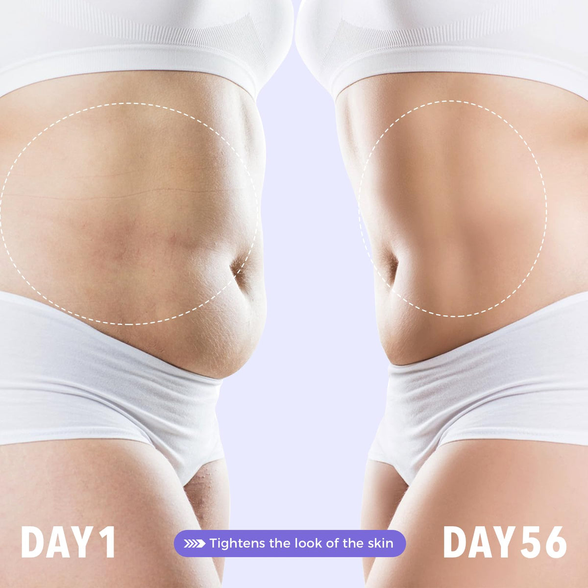 sperandi applied to belly demonstrating targeted firming benefit
