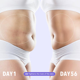 sperandi applied to belly demonstrating targeted firming benefit