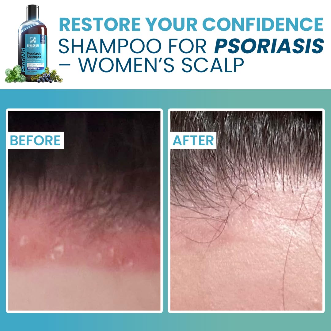 Sphagnum Botanicals menthol cooling action depicted during scalp massage for instant comfort