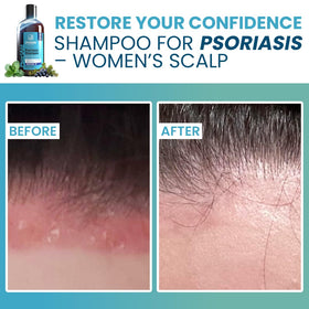 Sphagnum Botanicals menthol cooling action depicted during scalp massage for instant comfort