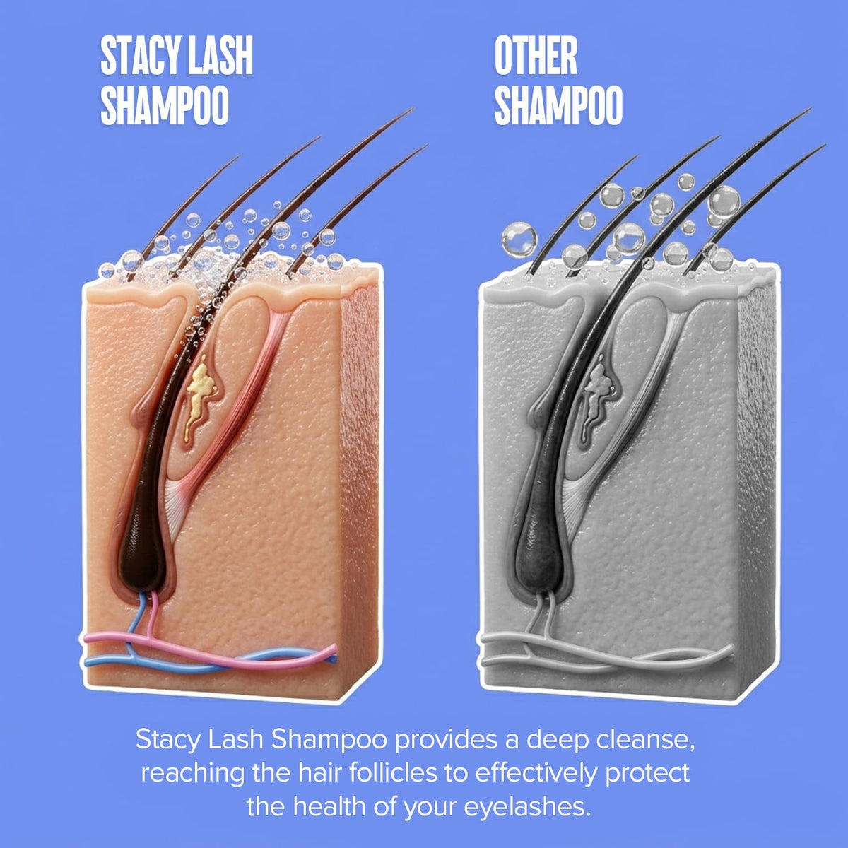 STACY LASH before and after lashes showing cleaner lash line and improved appearance