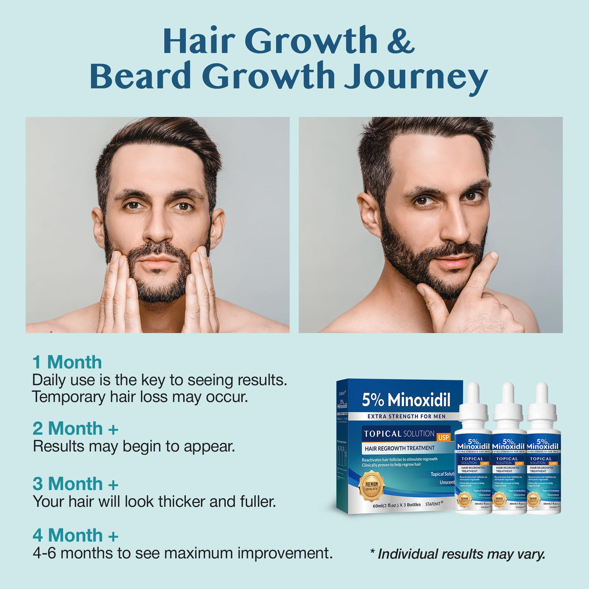 Stafenit applied to scalp showing direct treatment of thinning crown for density