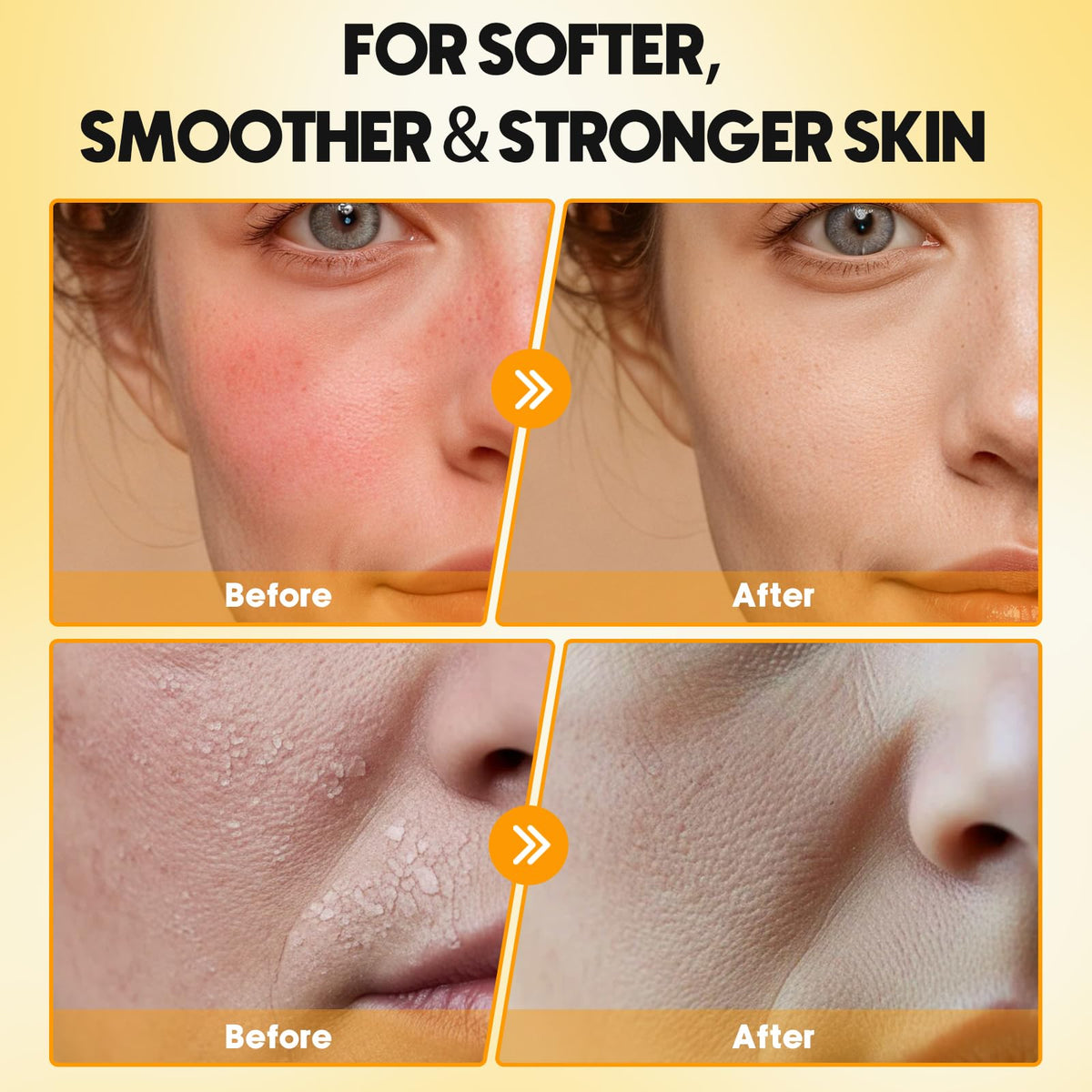 Starwise balm applied to cheek as facial moisturizer for sensitive skin