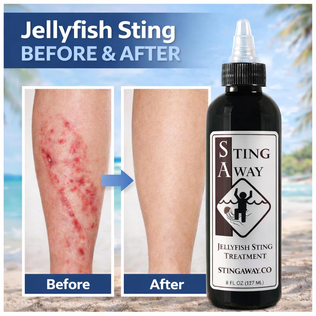 Sting Away applied to swimmer on beach easing pain after jellyfish sting
