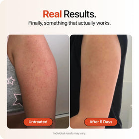 STRAWBERRY applied on arm showing smoothing action for softer, refined skin