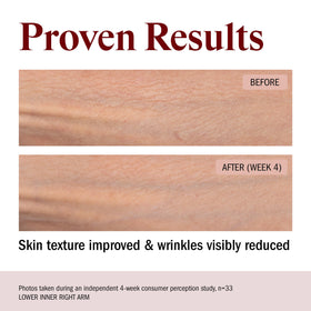 STRIPES application on legs and arms illustrating smoothing and coverage areas