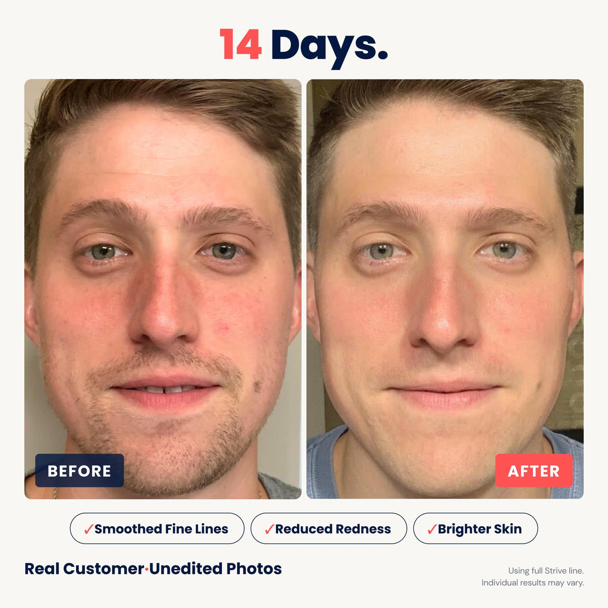Strive before after scale showing improved texture and reduced pores