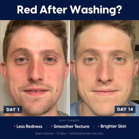 Strive rinsed skin showing smooth hydrated face and refreshed appearance