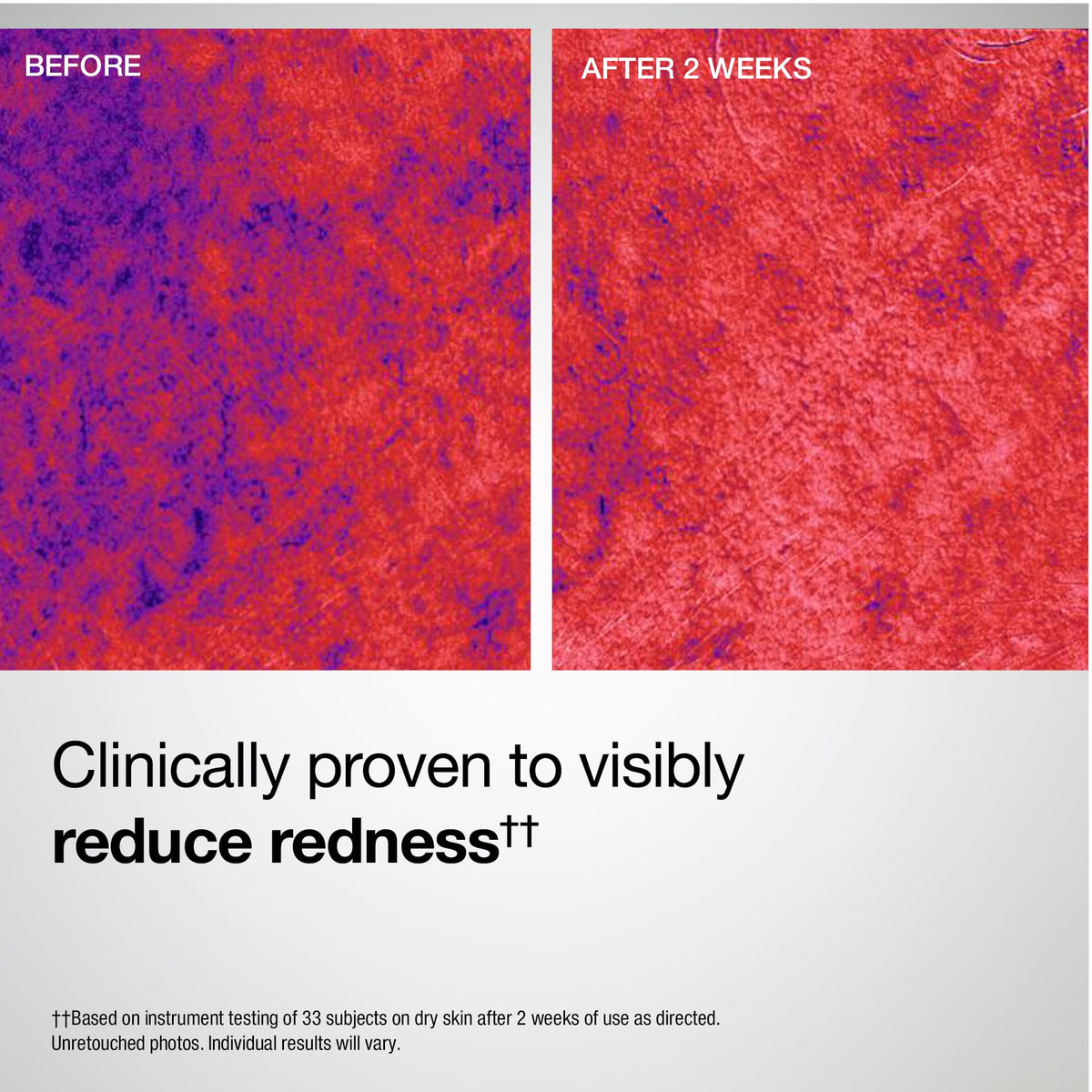 StriVectin after-spray close-up showing hydrated skin glow and improved texture