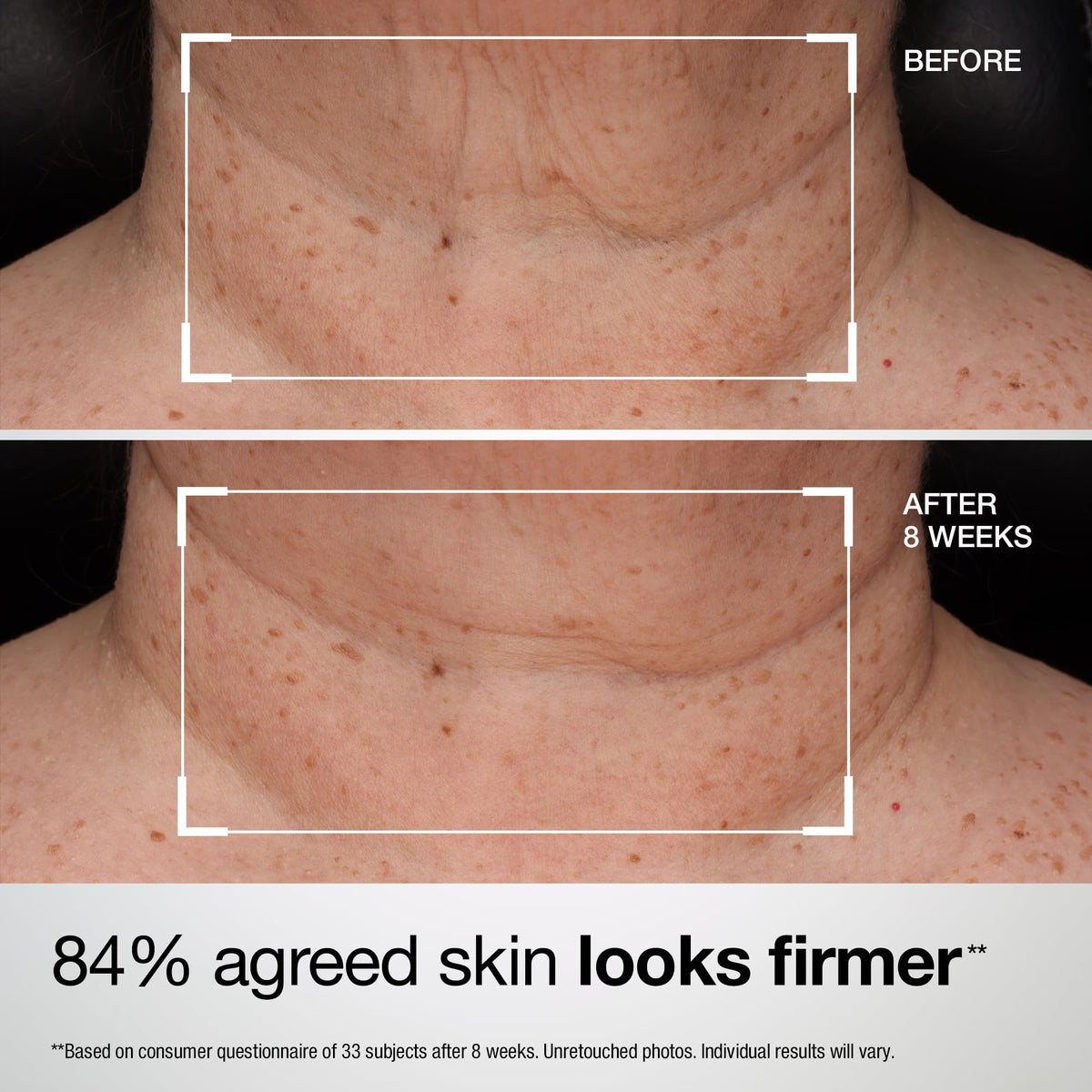 StriVectin applied to hand before neck use showing easy spreadability benefit